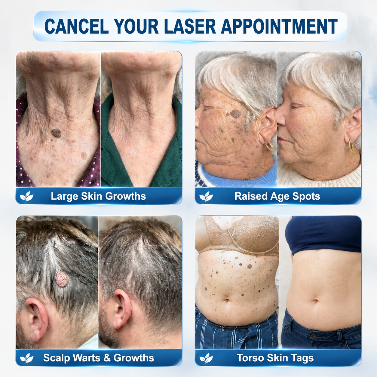 💎6-Pack👨‍⚕️Full-Body Clear Skin