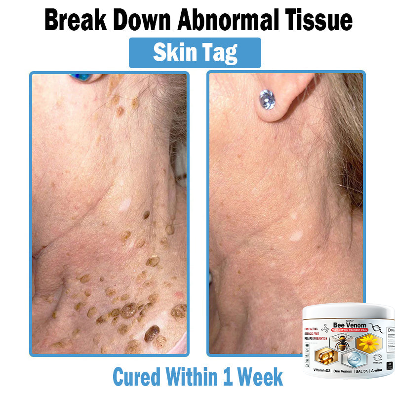 🔥4 Jars-Visible Skin Improvement